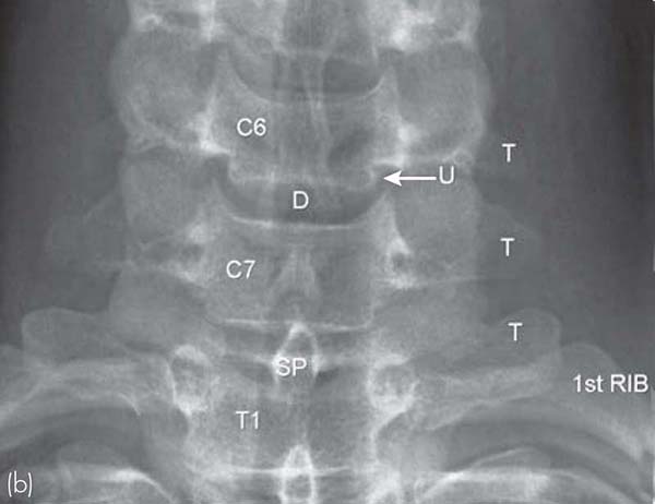 Spine Imaging