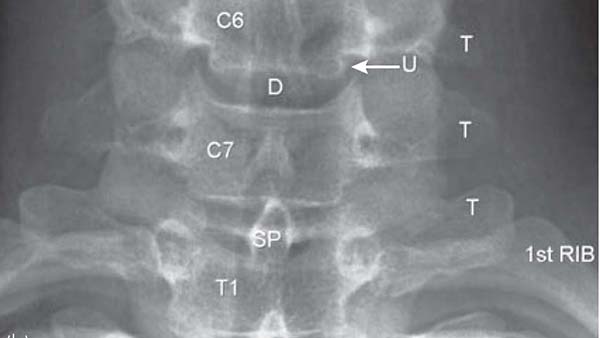 Spine Imaging