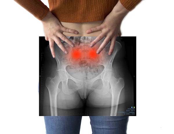 Sacroiliac Joint Pain