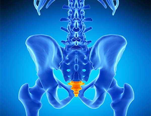 Picture of Coccydynia