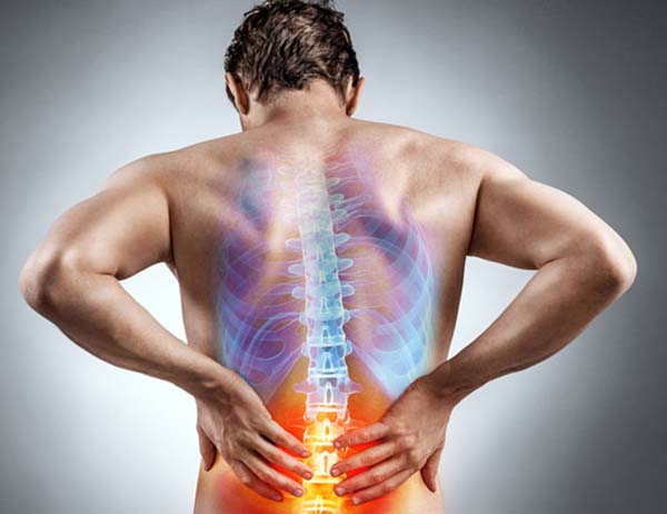 Picture of Acute Back Pain